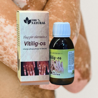 Тоник за витилиго (vitiligo)